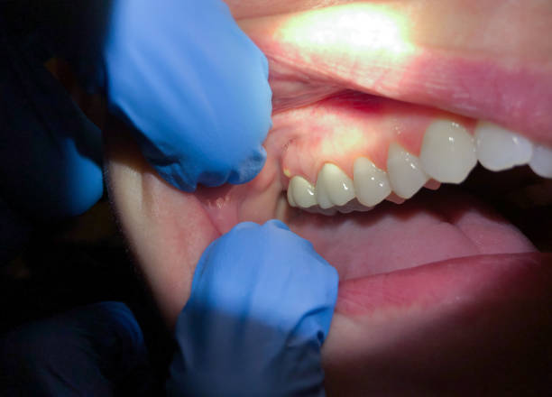 Best Pediatric Emergency Dentist in Ponca City, OK