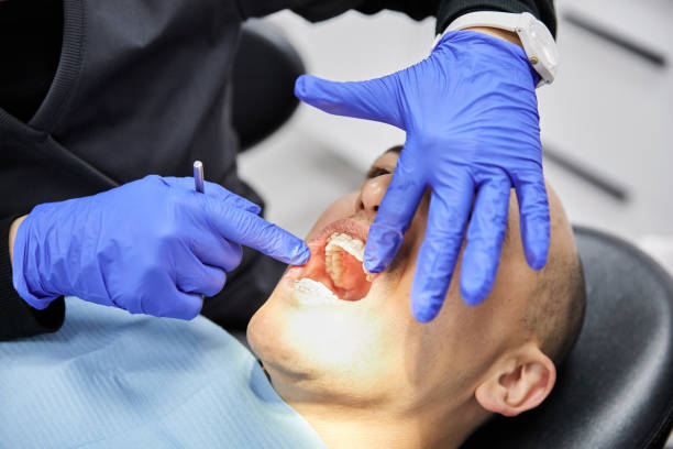 Best Emergency Wisdom Teeth Removal in Ponca City, OK